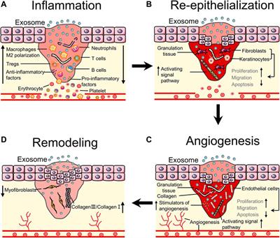 Exosome derived from stem cell: A promising therapeutics for wound healing